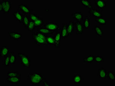 KDM6B Antibody