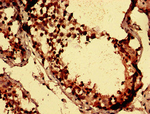 AXIN1 Antibody