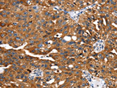 EGLN1 Antibody