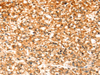 SLC32A1 Antibody