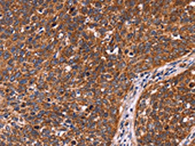 CCDC106 Antibody