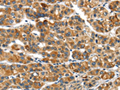 UBAP2 Antibody