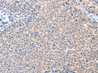 AADACL2 Antibody