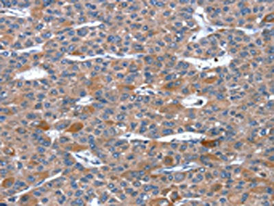 RGS11 Antibody