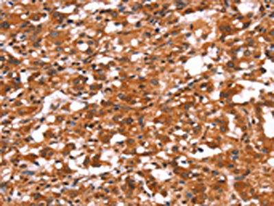 GABRA1 Antibody