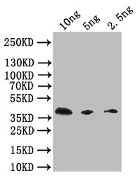 Extracellular calcium-sensing receptor Antibody