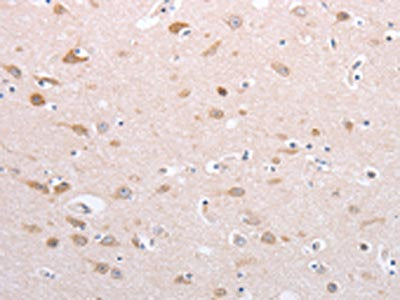 PFN4 Antibody