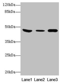 B4GALT5 Antibody