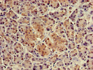 NUPR1 Antibody