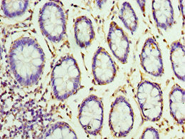 VENTX Antibody