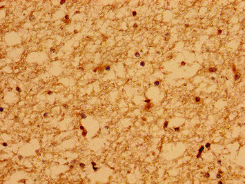 WDPCP Antibody