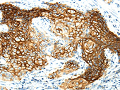 AQP3 Antibody