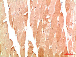 WIPI2 Antibody
