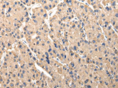 SERPINA7 Antibody
