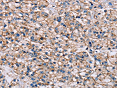 ADAM12 Antibody