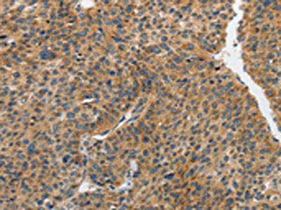 PIP5K1C Antibody