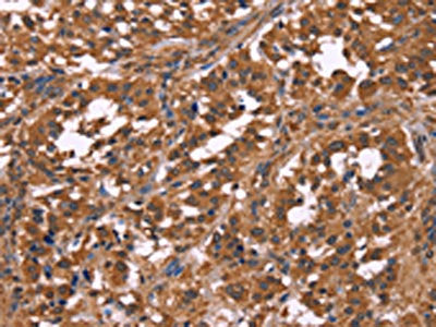 NOS2 Antibody