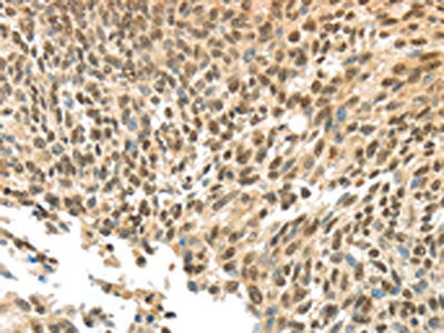 APOL6 Antibody