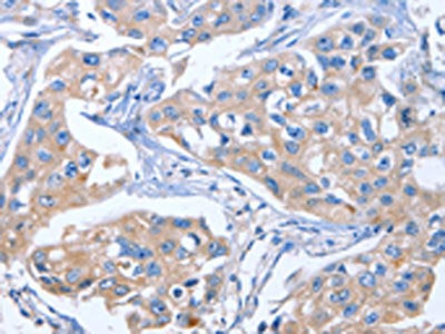 IBSP Antibody