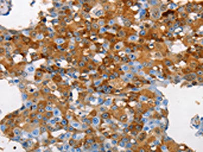MUC5B Antibody