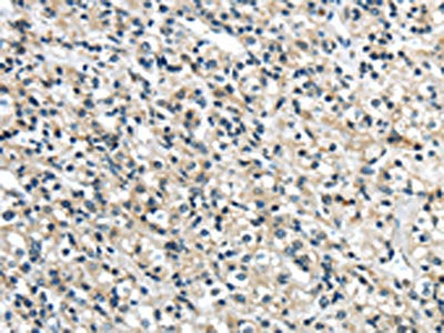 GRIN2A Antibody