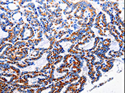 NFKB1 Antibody