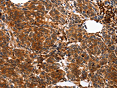 YWHAB Antibody