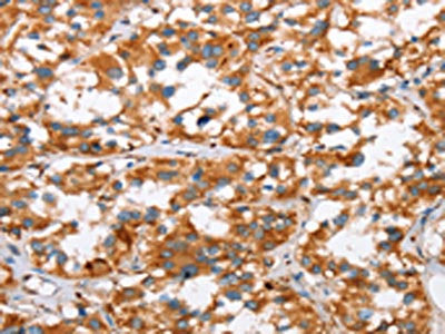 SLC4A1 Antibody