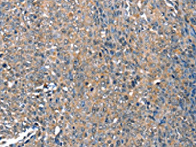 DEFA1 Antibody