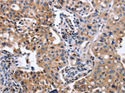 ITGB5 Antibody