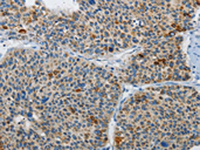 ATG4A Antibody
