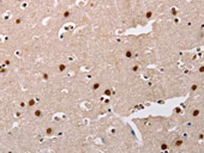 AKAP8L Antibody