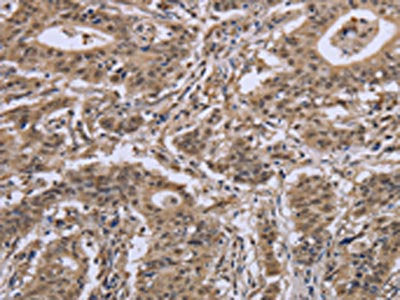 IPO8 Antibody