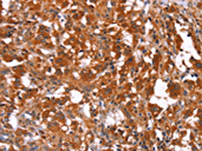 HAS1 Antibody