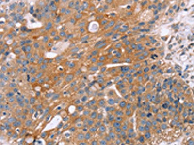 OPTN Antibody