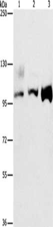 ASCC2 Antibody