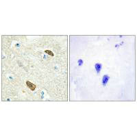 PLXDC1 Antibody