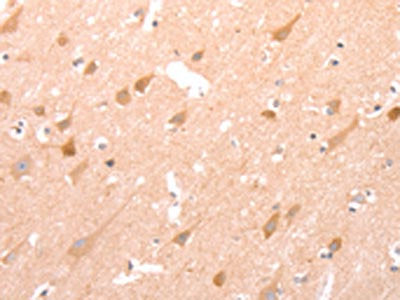 STRA8 Antibody