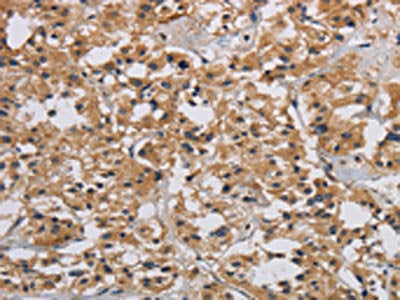 INPPL1 Antibody