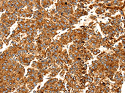 DOPEY1 Antibody