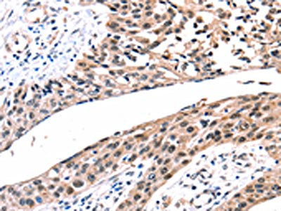 GJB2 Antibody
