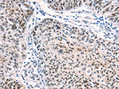 CTBP2 Antibody