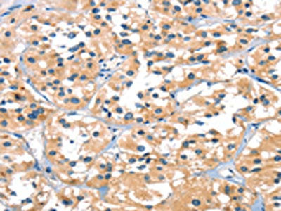 SLC6A4 Antibody