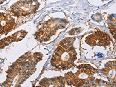 CA9 Antibody