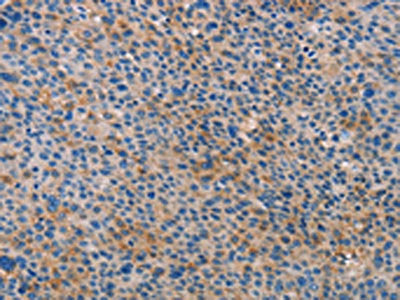 ALOX15B Antibody