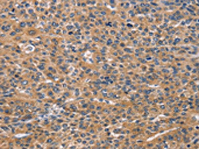 NCR2 Antibody