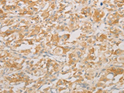 AES Antibody