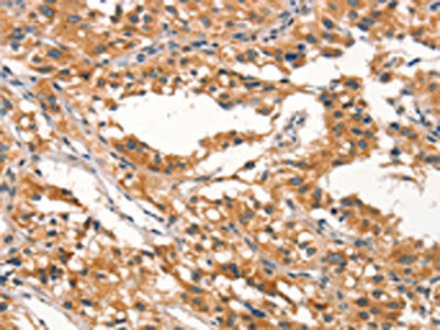 RHOBTB2 Antibody