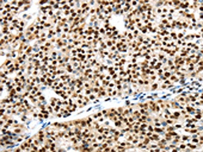 UBA1 Antibody