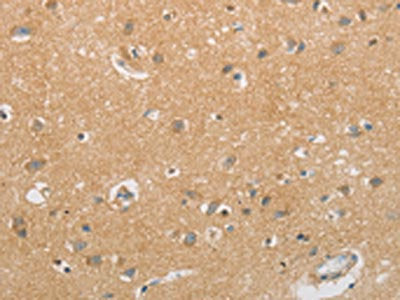GJB6 Antibody